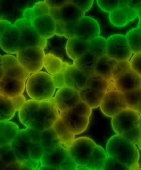 Microscopic image showing clusters of green and yellow bacterial cells on a dark background. - Olive Oil Times
